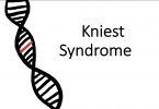 Kniest Syndrome